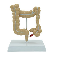 Modelo de Simulación Médica DARHMMY del Colon y Intestino Grueso Humano