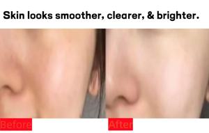 Essence nettoyante pour peau de <span class=keywords><strong>verre</strong></span> - Sérum à l'acide hyaluronique et à la niacinamide pour peaux sensibles - Product Image 6