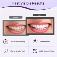 Kit de Blanqueamiento Dental Profesional de Lujo PAP+ Sin Peróxido - Gel Morado de Alta Potencia - No Sensibilizante, 14 Tiras para un Blanqueamiento Rápido en 7 Días