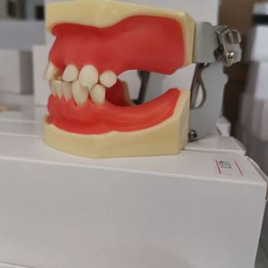 Modello di impianto dentale KyrenMed con edentulismo parziale nelle mascelle superiori e inferiori denti modello di pratica mancante - Product Image 5