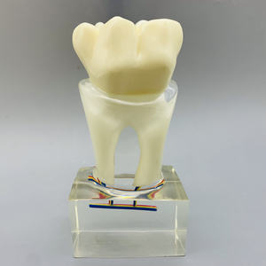 نموذج الفم 6 مرات نموذج عصب الأسنان مع تشريح الأعصاب للتعليم والعرض - Product Image 6