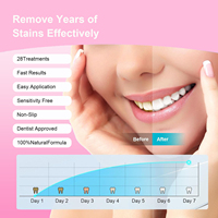 Meilleure nouvelle collection de bandes blanchissantes pour les dents de qualité supérieure sans peroxyde, traitement de 30 minutes pour une utilisation à domicile, blancheur éclatante