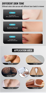 2026 New electrolysis hair removal machines 808nm Wavelength Body Armpit Leg Hair Removal Medical Grade Spa Center Equipment - Product Image 3