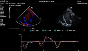 Mingray Vetus E7 sistem pencitraan mesin, alat pencitraan portabel untuk penggunaan dokter hewan - Product Image 6