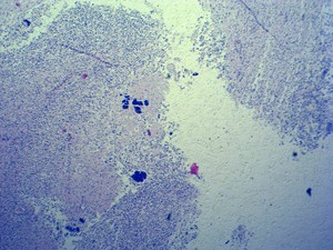 医学HenanYulinプロの人間の病理学スライド人間の炎症について - Product Image 4