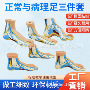 Présentation sur les pieds humains normaux, les pieds plats, les pieds arqués, les pieds hautement arqués, les arches plantaires, la pathologie des pieds, l'anatomie musculaire, etc. - Product Image 3