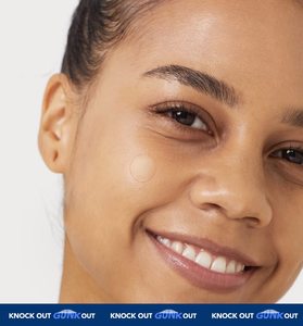 Apósitos autoadhesivos de alta absorción para úlceras por presión, cuidado del acné, rollo de hidrocoloide estéril e impermeable para el cuidado de heridas, certificado CE YOJO - Product Image 5