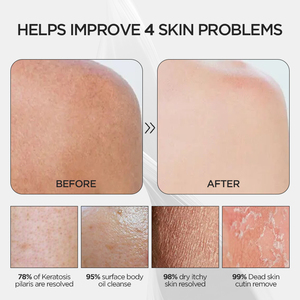 Paquet de marque avec logo personnalisé Kessa <span class=keywords><strong>Hammam</strong></span> gant de bain exfoliant marocain épurateur en fibre de viscose pour le corps - Product Image 4