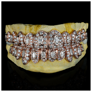 Grillz Moissanite VVS High-end 10 on 10 Perak S925 Emas Rose Solid 10k 14k 18k Bertabur Batu Hip Hop Unisex Bersertifikat untuk Gigi - Product Image 1