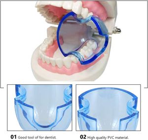 Alat Bedah Gigi Manual Pembuka Mulut Retraktor Pipi Intraoral Tongkat Penahan Gigi Ortodontik Sekali Pakai Grosir - Product Image 3