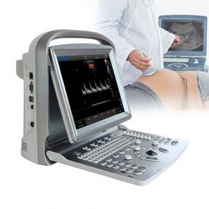 Peralatan USG Medis Doppler Warna 4D Portabel <span class=keywords><strong>Chison</strong></span> <span class=keywords><strong>ECO5</strong></span> untuk Peralatan Abdomen/Urologi/Vaskular - Product Image 1