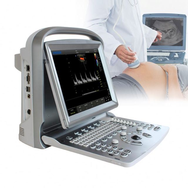 Chison ECO5 Portable 4D Color Doppler Medical Ultrasound Equipments for Abdomen /Urology/Vascular Equipment