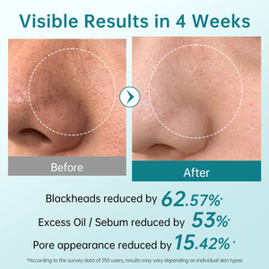 Vente en gros de serviettes de rajeunissement à l'acide salicylique marque privée nettoyage en profondeur exfoliant <span class=keywords><strong>visage</strong></span> contrôle de l'acné nettoyée pour - Product Image 5