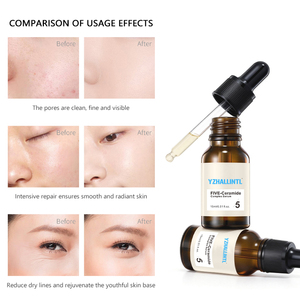 Suero Facial con Cinco Ceramidas para el Cuidado de la Piel, Hidratación Profunda, Alivio de la Sequedad, Calmante para la Sensibilidad, Complejo de Cinco Ceramidas - Product Image 4