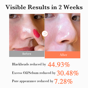 เซรั่มบำรุงผิวหน้าคุณภาพสูงจากเกาหลี ช่วยผลัดเซลล์ผิว ปรับสีผิวให้สม่ำเสมอ ลดเลือนจุดด่างดำ ด้วยสารสกัดจากกลูโคสและใบบัวบก - Product Image 4