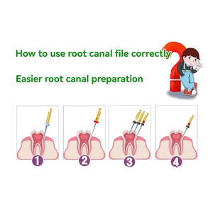 Limas de Conducto Radicular Dentales de Acero Inoxidable, Níquel Titanio, Anti-Rotura, Aguja de Ampliación Oral, Lima Cónica para <span class=keywords><strong>Abrir</strong></span> Canales - Product Image 5