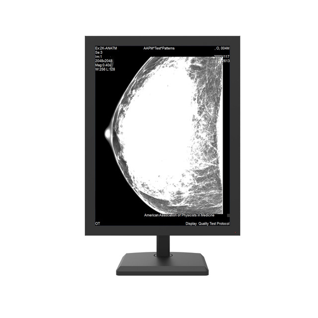 OEM Medical 3MP Grayscale Mammography Diagnostic Display LCD Monitor