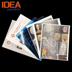 Film bleu pour imprimantes jet d'encre et laser, haute résolution, compatible DR, CT, IRM, CR, DICOM, pour imprimantes Epson et Fuji, directement de l'usine. - Product Image 4