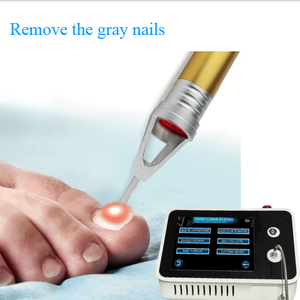 Máquina de Láser de Diodo de 980nm, Endoláser, Lipólisis, Tratamiento de Hongos en las Uñas, Fisioterapia, Eliminación Vascular, para Uso en Salones de Belleza - Product Image 5
