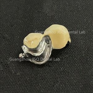 Dentaduras postizas totalmente cerámicas Zirconia o dentaduras postizas Pfm Tipos de Diseño Digital en <span class=keywords><strong>Exocad</strong></span> Rápido y eficiente - Product Image 4