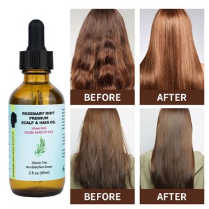 Suero de Aceite de Romero Nutritivo Más Vendido <span class=keywords><strong>para</strong></span> Reparación y Suavizado del Cabello, Uso Doméstico - Product Image 3