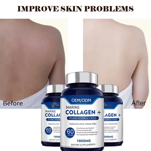 Complément alimentaire super-aliment à base de collagène marin en gélules molles, hydrolysé pur, avec vitamines C et E, protéines et acides aminés, compatible OEM - Product Image 4