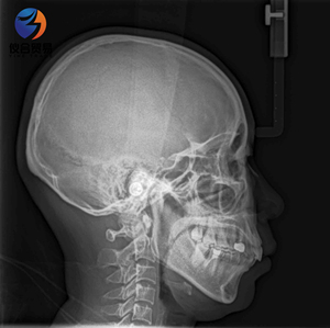Appareil d'imagerie <span class=keywords><strong>panoramique</strong></span> et céphalométrique <span class=keywords><strong>dentaire</strong></span> simple d'utilisation, innovation en matière d'imagerie - Product Image 3