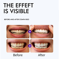 Tiras Blanqueadoras de Dientes Profesionales, Sonrisa Brillante y Hermosa, Sin Sensibilidad, Sin Peróxido, 7 Pares, 14 Tiras