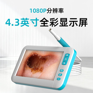 Visualized Ear Cleaning Instrument 2.0Mp Camera 1500mm Working Length Otoscope For Ear Wax Removal - Product Image 4