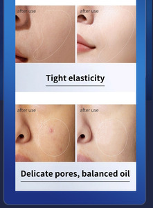 Masajeador de piel facial antienvejecimiento Estiramiento facial Eliminación de cicatrices de acné Dispositivo profesional antiarrugas - Product Image 6