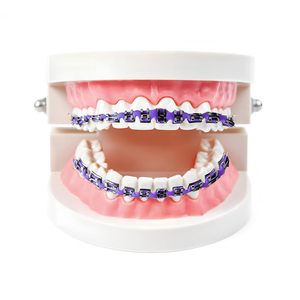 Decoración Dental Temporal con Alambres Metálicos, Brackets y Ligaduras de Ortodoncia, para Decoración Dental de Ortodoncia o DIY - Product Image 3