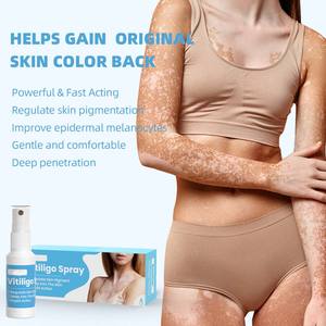 Traitement du <span class=keywords><strong>vitiligo</strong></span> à base de plantes 30ml Vente en gros Soins de la peau Spray dissolvant de taches blanches - Product Image 5