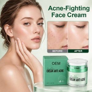 Crème anti-acné personnalisée qui réduit <span class=keywords><strong>les</strong></span> <span class=keywords><strong>taches</strong></span> et la matité, crème de traitement des boutons <span class=keywords><strong>pour</strong></span> le visage, acide salicylique, niacinamide, crème <span class=keywords><strong>pour</strong></span> éliminer <span class=keywords><strong>les</strong></span> cicatrices d'acné - Product Image 1