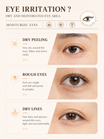 Patchs de gel pour les yeux au riz hydrolysé Clean Beauty, masque hydratant pour les yeux contre les poches, les cernes, les ridules et les yeux fatigués