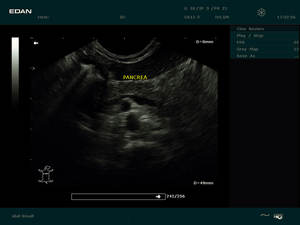 Échographe vétérinaire <span class=keywords><strong>portable</strong></span> <span class=keywords><strong>Edan</strong></span> DUS60 vétérinaire échographe échographe avec sonde rectale - Product Image 5