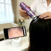 Scalp Hair Analysis Microscope WIFI Dual Light Source AI Smart Detector for Beauty Salon Home Scalp Care Hair Follicle Detection