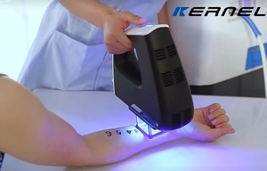 Lampu Terapi <span class=keywords><strong>Laser</strong></span> Excimer 308nm Profesional KN-5000D XeCl untuk Vitiligo Psoriasis Peralatan Medis Pasokan Pabrik - Product Image 5