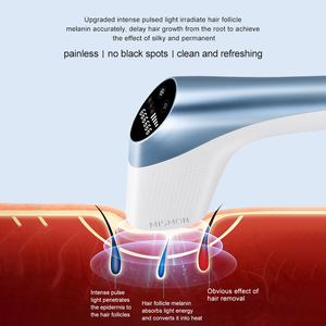 Épilateur <span class=keywords><strong>laser</strong></span> IPL à <span class=keywords><strong>lumière</strong></span> <span class=keywords><strong>pulsée</strong></span> intense MiSMON - Product Image 5
