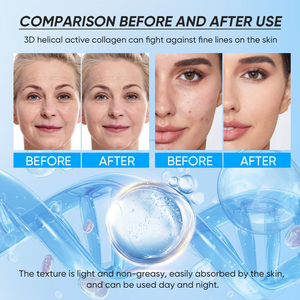 ครีมบำรุงผิวหน้า CHIC BEAUTE ช่วยยกกระชับ ลดเลือนริ้วรอย ช่วยเติมความชุ่มชื้น ลดเลือนริ้วรอยเล็กๆ คอลลาเจน ลดเลือนริ้วรอยทันที - Product Image 3