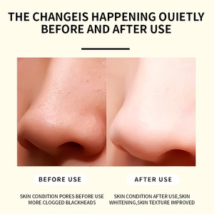 แผ่นมาส์กหน้าเฮเซลแบบลอกออกได้สำหรับขัดจมูกแผ่นลอกสิวเสี้ยน - Product Image 3