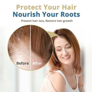 Siero al Rosmarino e Saw Palmetto per la Crescita dei Capelli, Oli di Semi di Zucca, Ispessimento e Idratazione, Trattamento Anticaduta per Donne e Uomini - Product Image 2