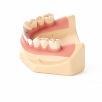 Modèle de démonstration dentaire Ecolab de qualité médicale, modèle Malo Bridge, couronne en zircone, prothèse implantaire pour étudiants en dentisterie, conforme ISO