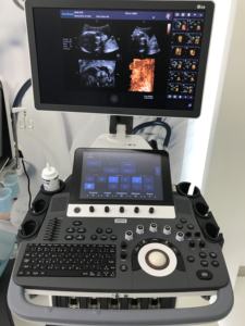 Sonosape S50 troli <span class=keywords><strong>4d</strong></span> warna doppler mesin <span class=keywords><strong>ultrasound</strong></span> klinik rumah sakit profesional - Product Image 4