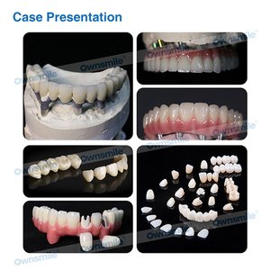 Ownsmile - Discos de Zirconia Multicapa 3D Pro de 9 Capas para CAD/CAM, Discos de Cerámica de Zirconia para Puentes, Coronas, Carillas y Restauraciones - Product Image 2