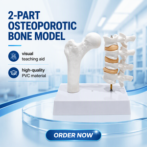 Modelo Patológico de Osteoporosis Humana en 2 Partes, Modelo de Comparación de Estructura Ósea de PVC para la Enseñanza de Anatomía Médica, CE/ISO/ROHS/CNAS - Product Image 1