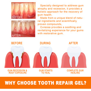 Descuento en cuidado bucal Limpieza de dientes blanqueamiento Reparación de encías tratamiento ampolla suero 7PCS Set - Product Image 3
