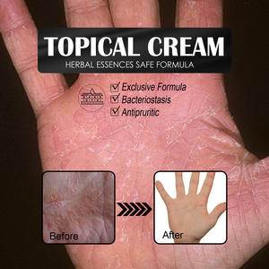 <span class=keywords><strong>Crème</strong></span> antiprurigineuse biologique topique pour le <span class=keywords><strong>visage</strong></span> Pied Sueur Blister Moustique Morsure Démangeaisons sèches Lotion réparatrice pour la peau Revitalisant pour la peau - Product Image 5