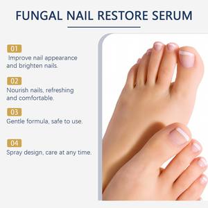 OEM ODM Venta al por mayor 20ml Bee Venom Anti-Fungal Nail Hand Foot Spray Nail Fungus Removal Liquid Mist para el cuidado <span class=keywords><strong>de</strong></span> <span class=keywords><strong>la</strong></span> piel - Product Image 4