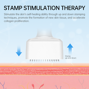 ล่าสุดร้อน Derma STAMP ปรับ140A ความยาวเข็มปากกา microneedling ลูกกลิ้ง0.5มม. สำหรับการดูแลผิวรอยแผลเป็นจากสิว - Product Image 4