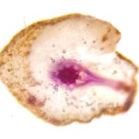 Kit de Tinción de Lignina de Alta Calidad Solarbio (Método de Floroglucinol) para Investigación Científica